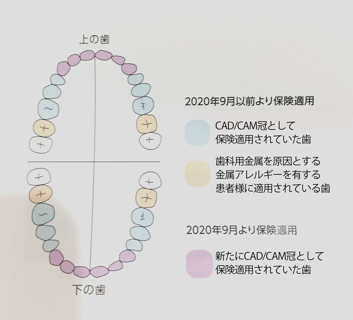 よしだ歯科クリニック 西宮市小曽根町の歯医者 歯科